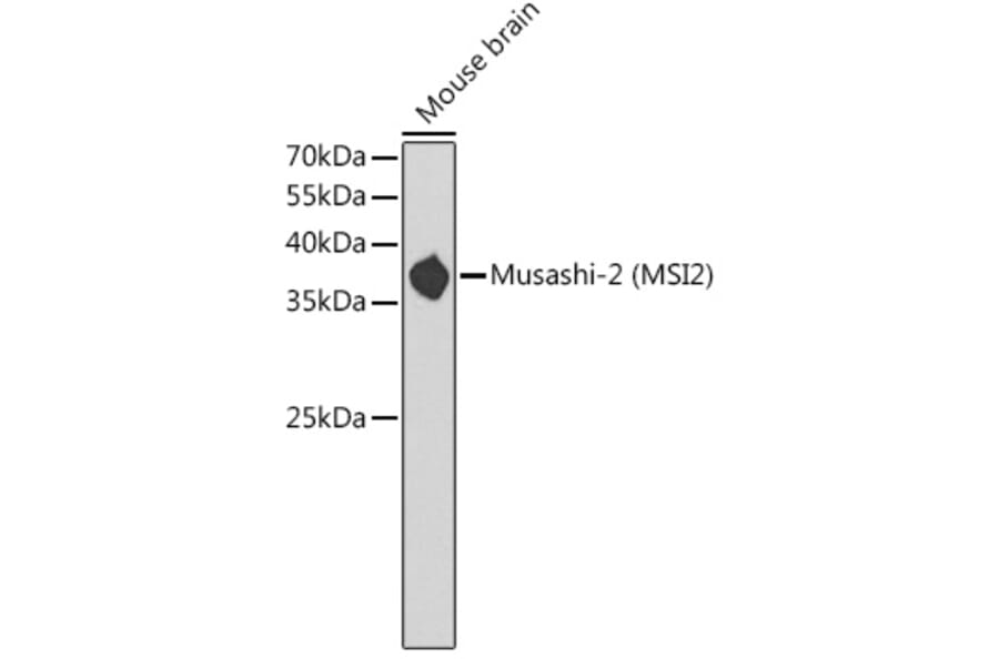 Western Blot - Anti-MSI2 Antibody (A11911) - Antibodies.com