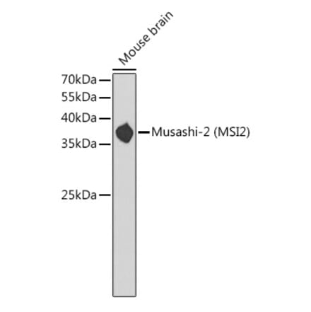 Western Blot - Anti-MSI2 Antibody (A11911) - Antibodies.com