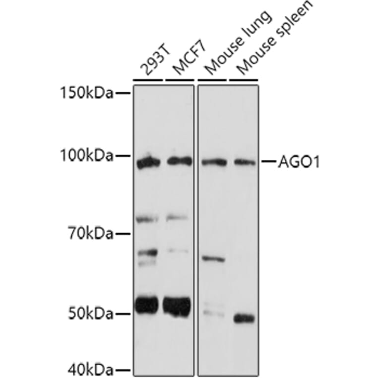 Western Blot - Anti-Ago1 Antibody (A11912) - Antibodies.com