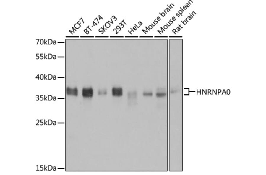 Western Blot - Anti-HNRNPA0 Antibody (A11913) - Antibodies.com
