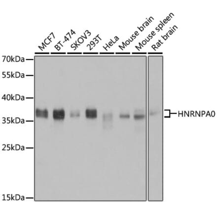 Western Blot - Anti-HNRNPA0 Antibody (A11913) - Antibodies.com