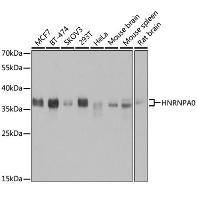 Western Blot - Anti-HNRNPA0 Antibody (A11913) - Antibodies.com