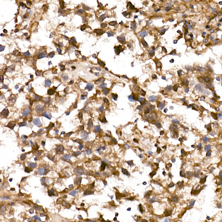 Immunohistochemistry - Anti-Lin28A Antibody (A11914) - Antibodies.com