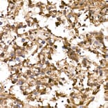 Immunohistochemistry - Anti-Lin28A Antibody (A11914) - Antibodies.com