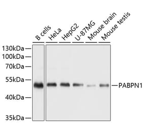 Western Blot - Anti-PABPN1 Antibody (A11915) - Antibodies.com