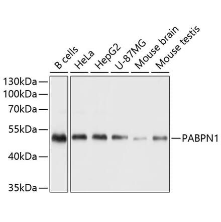 Western Blot - Anti-PABPN1 Antibody (A11915) - Antibodies.com