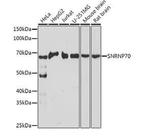 Western Blot - Anti-SNRNP70 Antibody (A11916) - Antibodies.com