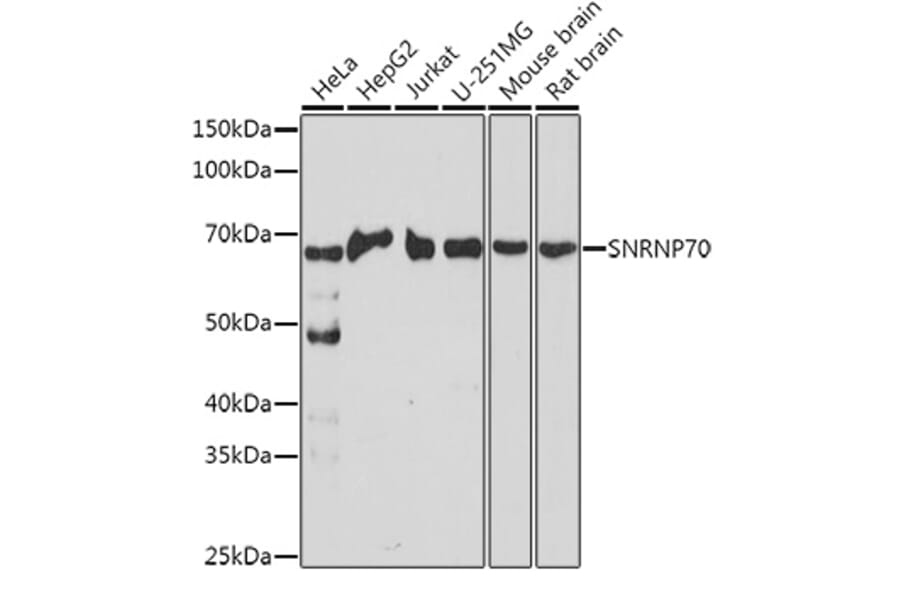Western Blot - Anti-SNRNP70 Antibody (A11916) - Antibodies.com