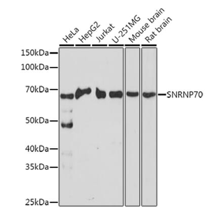Western Blot - Anti-SNRNP70 Antibody (A11916) - Antibodies.com