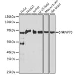 Western Blot - Anti-SNRNP70 Antibody (A11916) - Antibodies.com