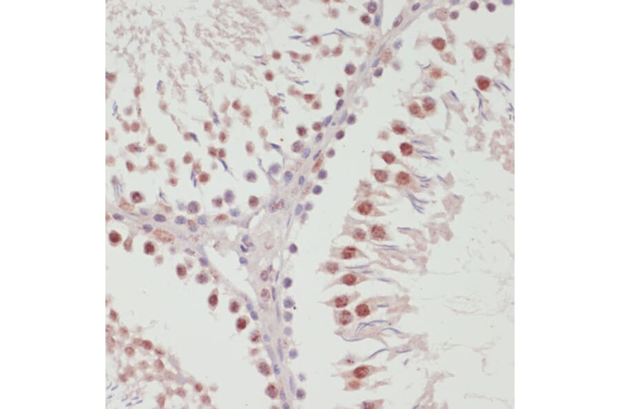 Immunohistochemistry - Anti-SNRNP70 Antibody (A11916) - Antibodies.com