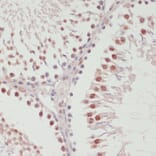 Immunohistochemistry - Anti-SNRNP70 Antibody (A11916) - Antibodies.com