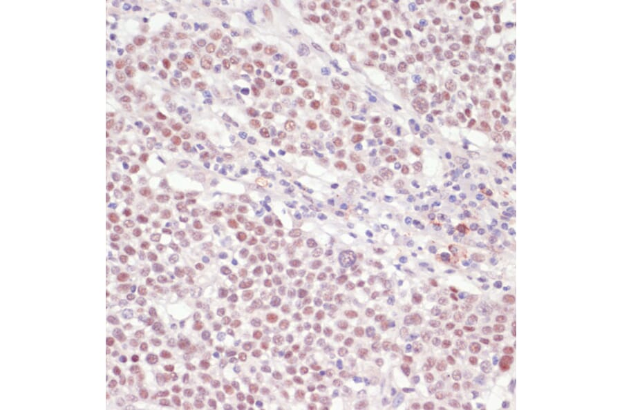 Immunohistochemistry - Anti-SNRNP70 Antibody (A11916) - Antibodies.com