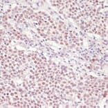 Immunohistochemistry - Anti-SNRNP70 Antibody (A11916) - Antibodies.com