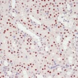 Immunohistochemistry - Anti-SNRNP70 Antibody (A11916) - Antibodies.com