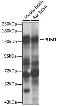 Western blot analysis of extracts of various cell lines, using Anti-PUM1 Antibody (A6108) at 1:1,000 dilution.
Secondary antibody: Goat Anti-Rabbit IgG (H+L) (HRP) (AS014) at 1:10,000 dilution.
Lysates / proteins: 25µg per lane.
Blocking buffer: 3% non-fat dry milk in TBST.
Detection: ECL Enhanced Kit (RM00021).
Exposure time: 15s.