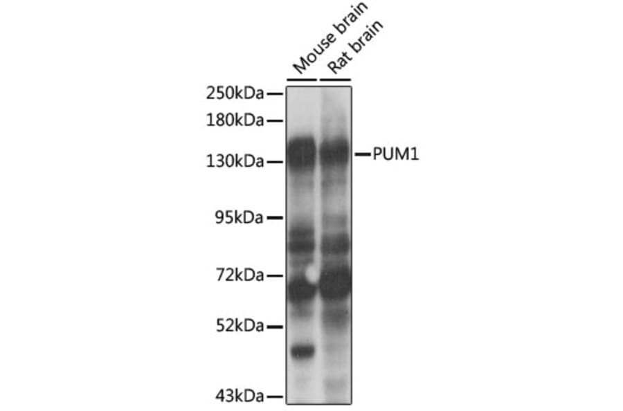Western Blot - Anti-PUM1 Antibody (A6108) - Antibodies.com