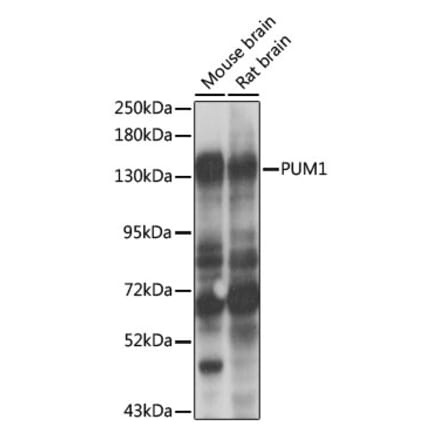 Western Blot - Anti-PUM1 Antibody (A6108) - Antibodies.com