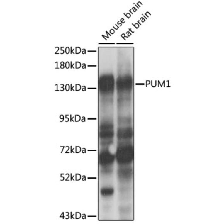 Western Blot - Anti-PUM1 Antibody (A6108) - Antibodies.com