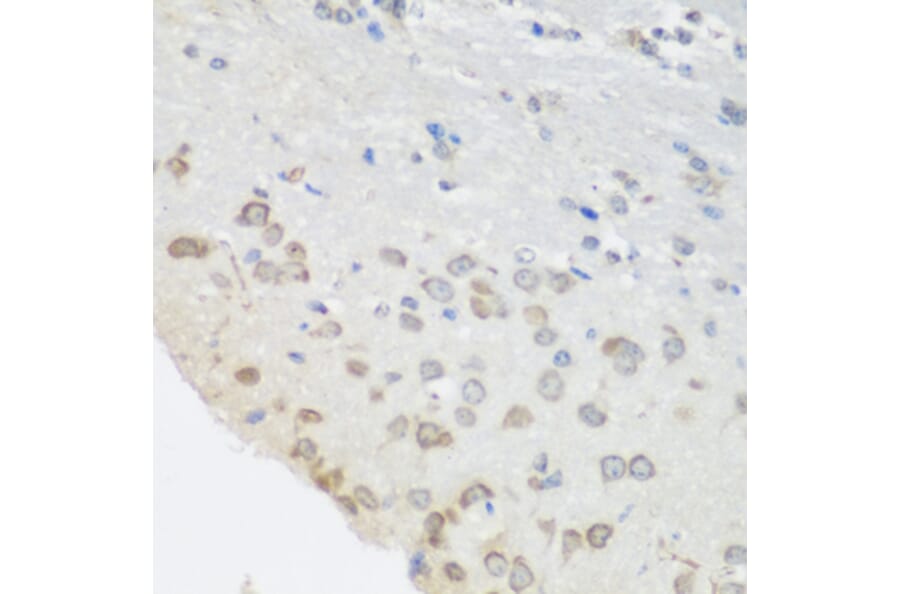 Immunohistochemistry - Anti-PUM1 Antibody (A6108) - Antibodies.com