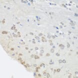 Immunohistochemistry - Anti-PUM1 Antibody (A6108) - Antibodies.com