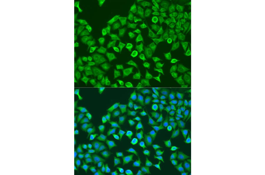 Immunofluorescence - Anti-PUM1 Antibody (A6108) - Antibodies.com