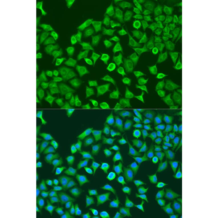 Immunofluorescence - Anti-PUM1 Antibody (A6108) - Antibodies.com