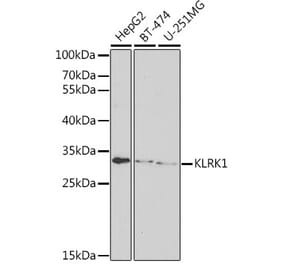 Western Blot - Anti-NKG2D Antibody (A11918) - Antibodies.com