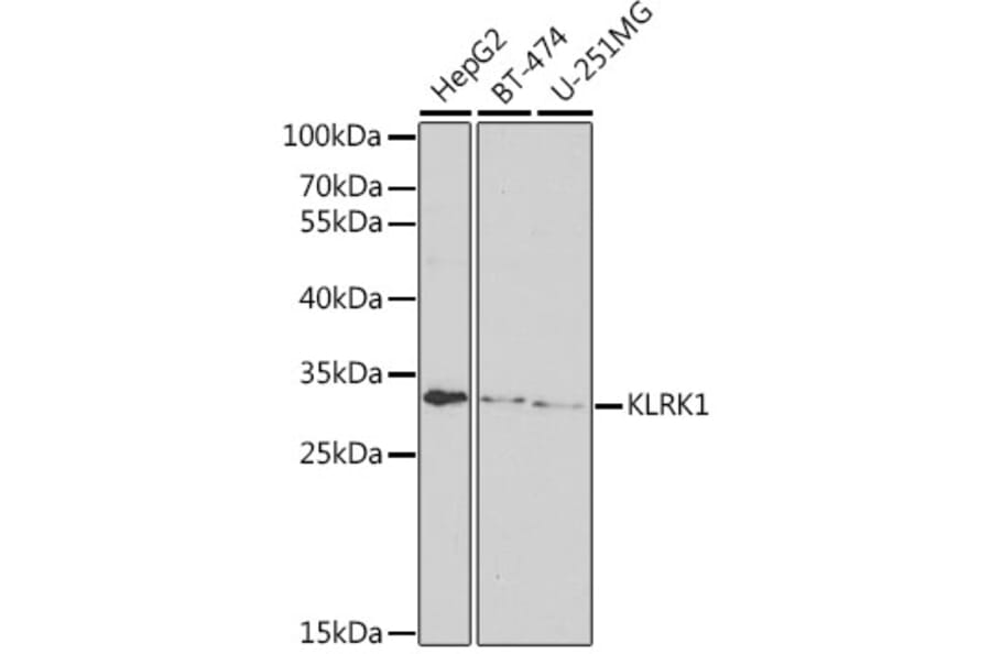 Western Blot - Anti-NKG2D Antibody (A11918) - Antibodies.com