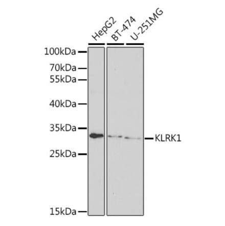 Western Blot - Anti-NKG2D Antibody (A11918) - Antibodies.com
