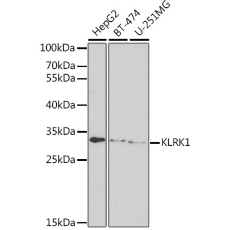 Western Blot - Anti-NKG2D Antibody (A11918) - Antibodies.com