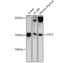 Western Blot - Anti-GM-CSF Antibody (A11919) - Antibodies.com