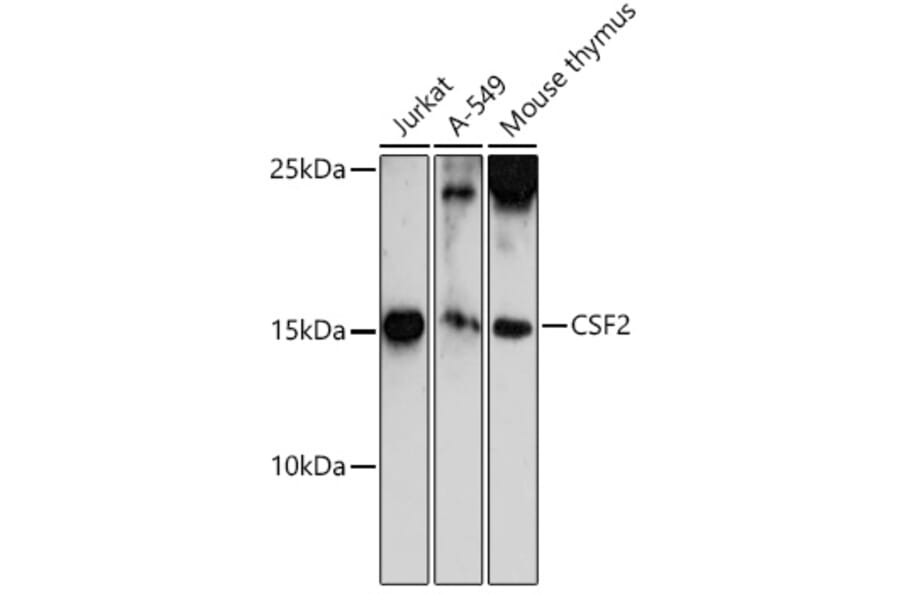 AntiGMCSF Antibody (A11919)