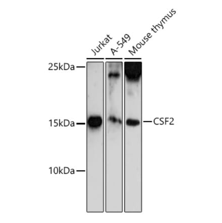 Western Blot - Anti-GM-CSF Antibody (A11919) - Antibodies.com