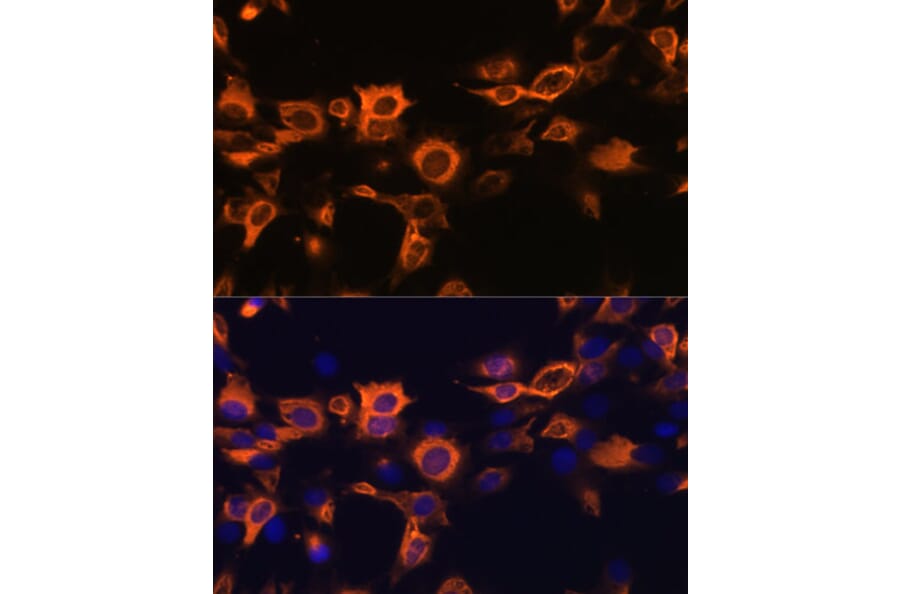AntiGMCSF Antibody (A11919)