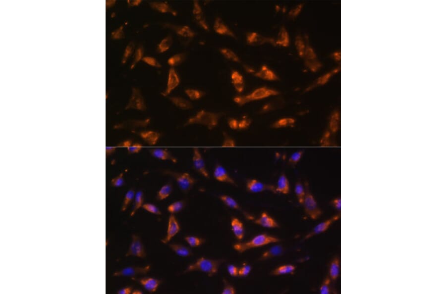 Anti-GM-CSF Antibody (A11919) | Antibodies.com