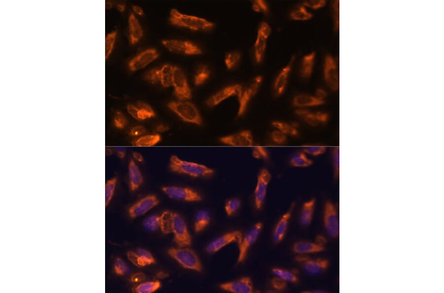 Immunofluorescence - Anti-GM-CSF Antibody (A11919) - Antibodies.com