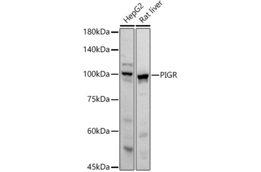 Western Blot - Anti-Polymeric immunoglobulin receptor/PIGR Antibody (A11920) - Antibodies.com