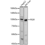 Western Blot - Anti-Polymeric immunoglobulin receptor/PIGR Antibody (A11920) - Antibodies.com
