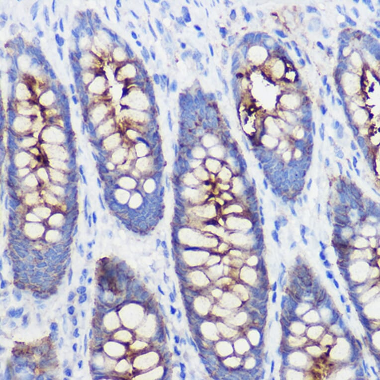 Immunohistochemistry - Anti-Polymeric immunoglobulin receptor/PIGR Antibody (A11920) - Antibodies.com