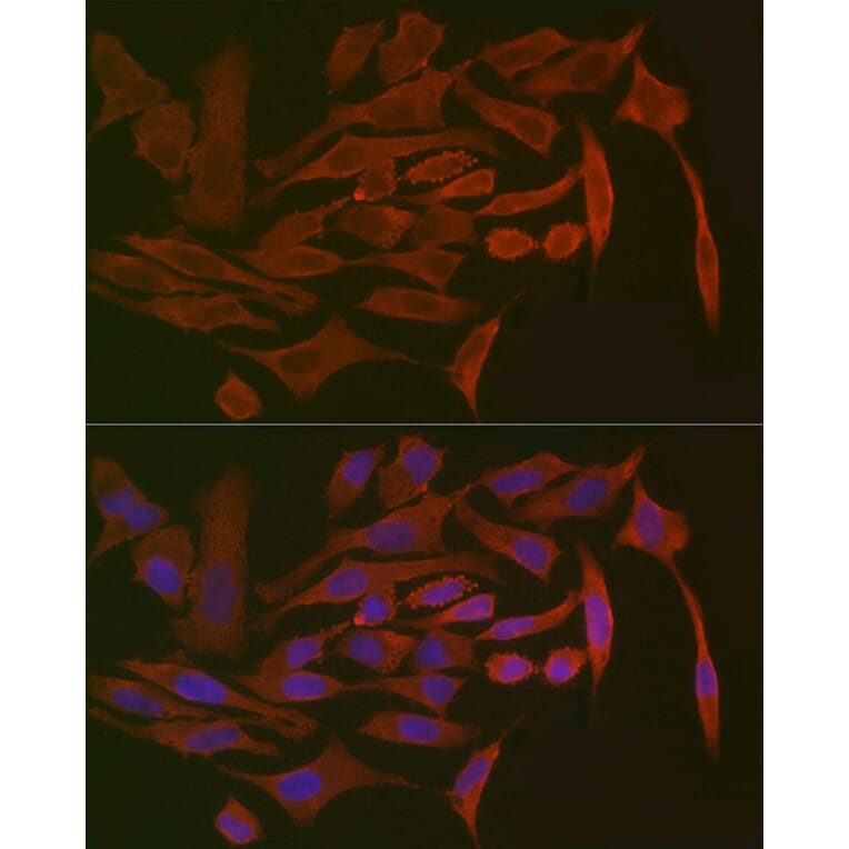 Immunofluorescence - Anti-Polymeric immunoglobulin receptor/PIGR Antibody (A11920) - Antibodies.com