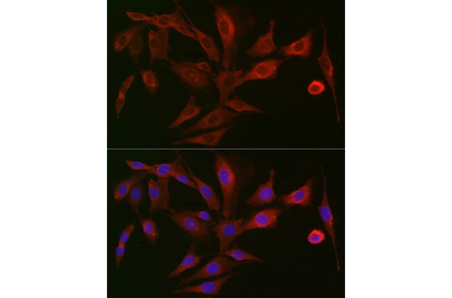 Immunofluorescence - Anti-Polymeric immunoglobulin receptor/PIGR Antibody (A11920) - Antibodies.com