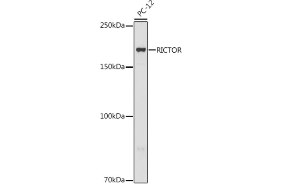 Western Blot - Anti-RICTOR Antibody (A11921) - Antibodies.com