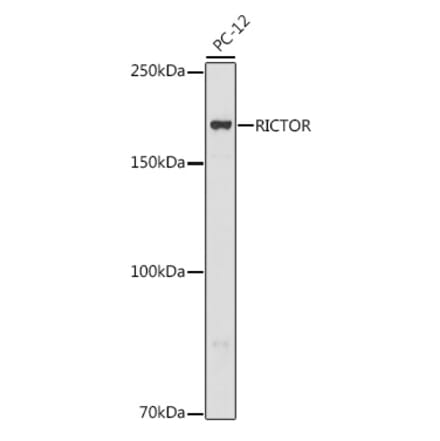 Western Blot - Anti-RICTOR Antibody (A11921) - Antibodies.com