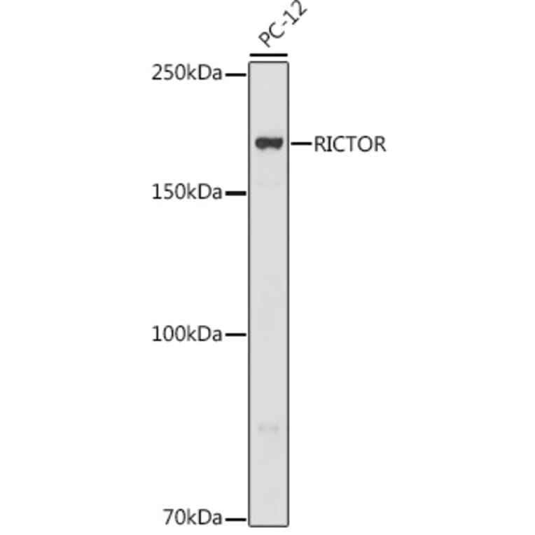 Western Blot - Anti-RICTOR Antibody (A11921) - Antibodies.com