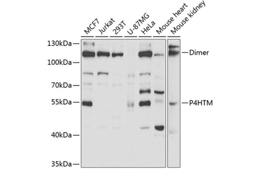 Western Blot - Anti-P4HTM Antibody (A6143) - Antibodies.com