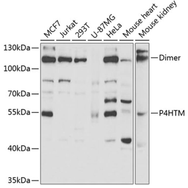 Western Blot - Anti-P4HTM Antibody (A6143) - Antibodies.com