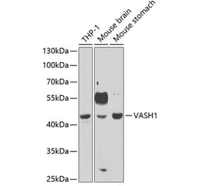 Western Blot - Anti-VASH1 Antibody (A11924) - Antibodies.com