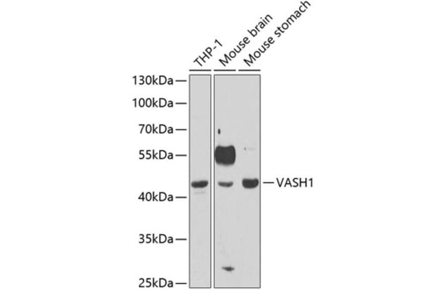 Western Blot - Anti-VASH1 Antibody (A11924) - Antibodies.com