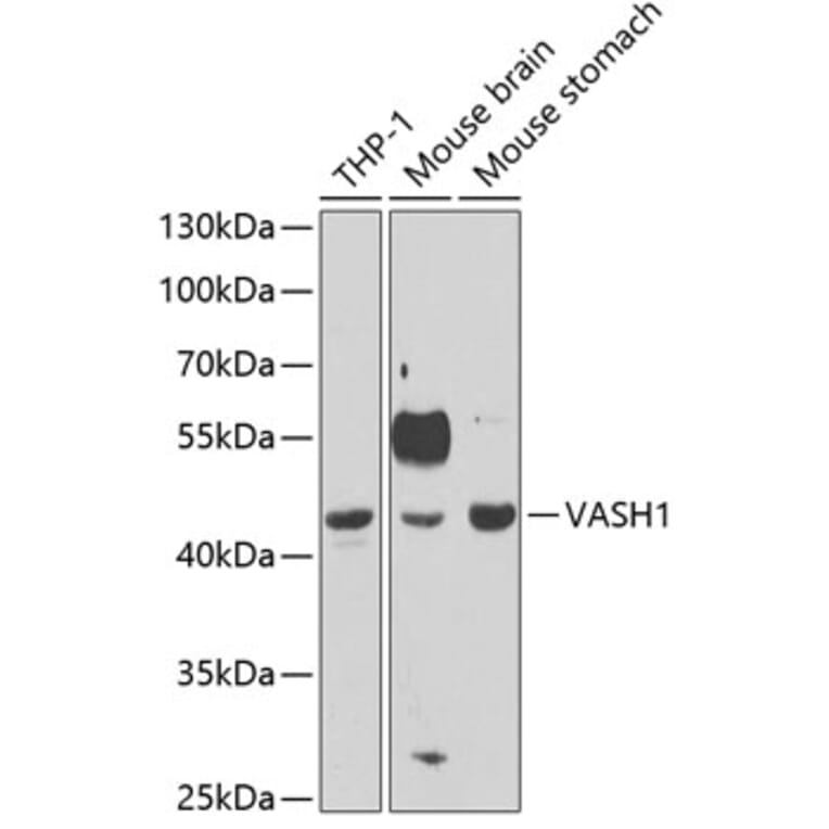 Western Blot - Anti-VASH1 Antibody (A11924) - Antibodies.com